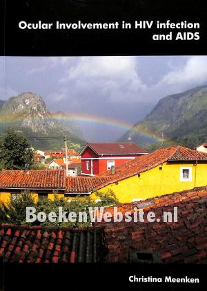 Ocular Involvement in HIV infection and AIDS