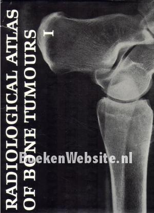 Radiological Atlas of Bone Tumours I