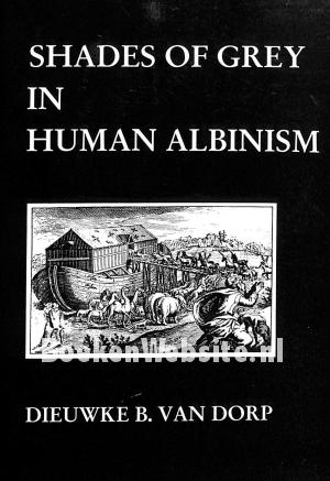 Shades of Grey in Human Albinism